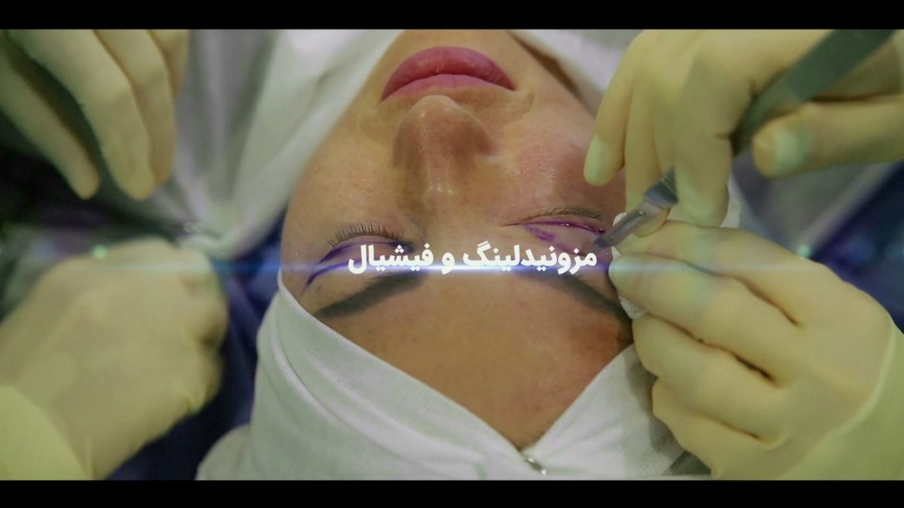 پروژه تیزر سالن زیبایی سبک کلاسیک - پروژه تیزر کلینیک زیبایی آرایشی ادیوس