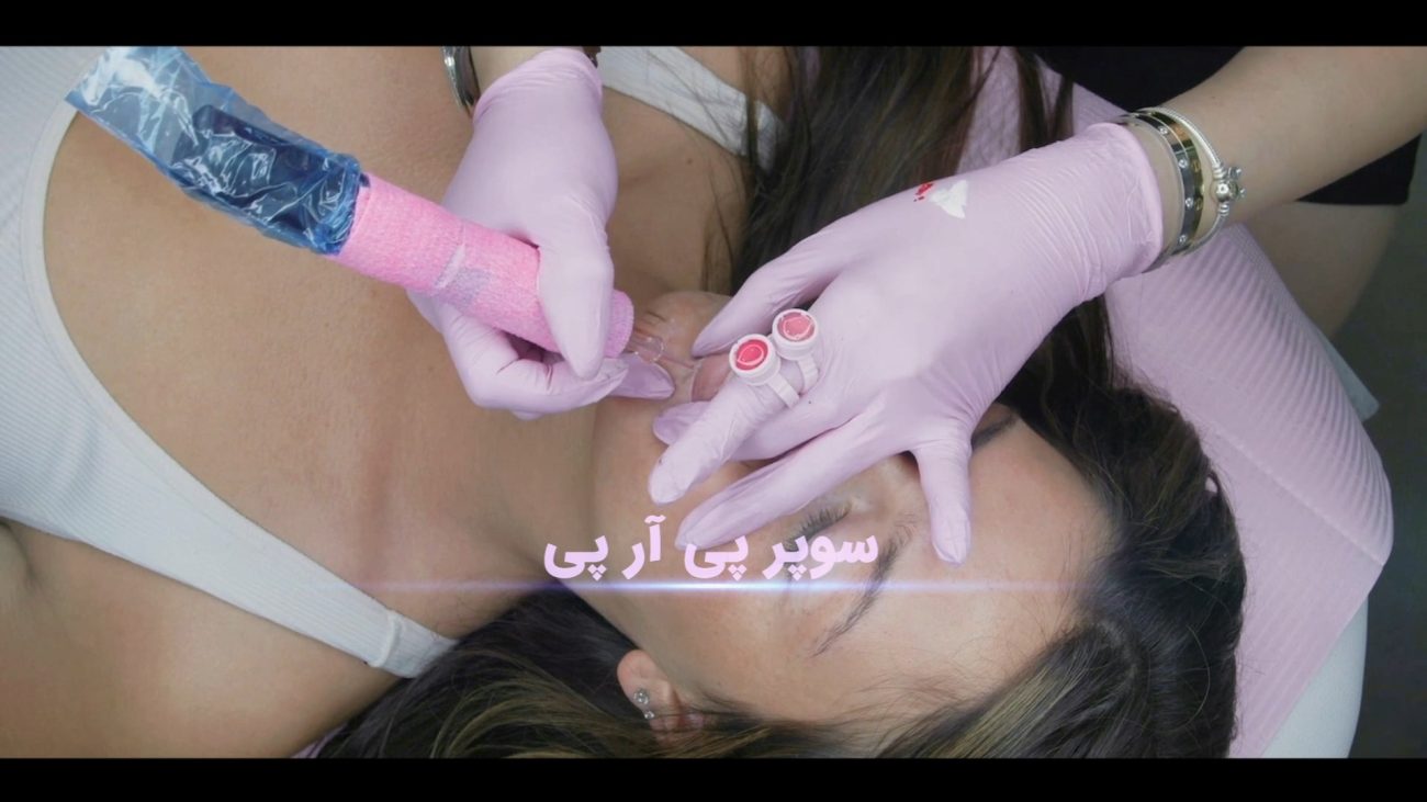 پروژه تیزر کلینیک زیبایی آرایشی -پروژه کلیپ تبلیغاتی ادیوس (201)